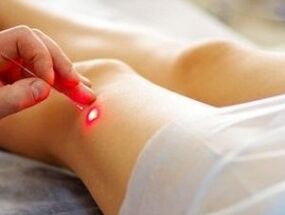 Лечение на артроза на колянната става с лазер